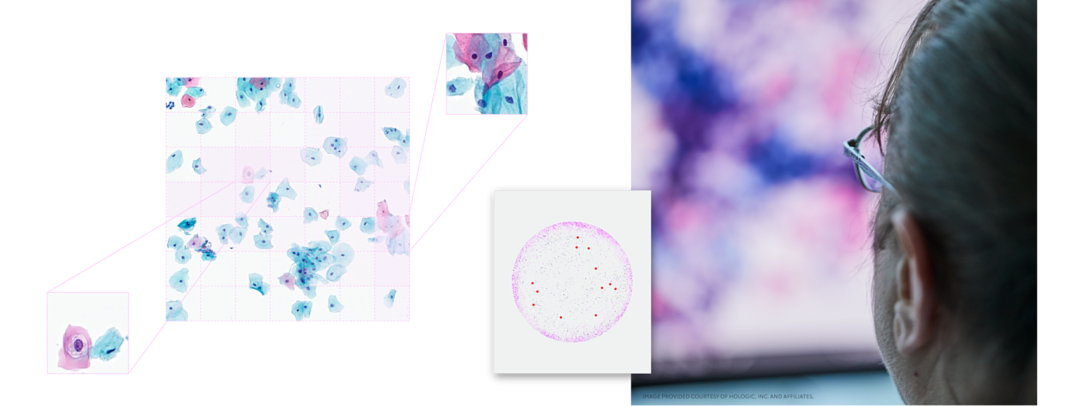 Image of Cancer cell full width 011123